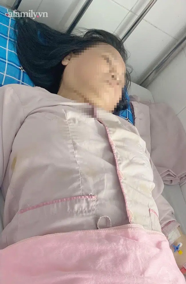 Đau bụng dữ dội nhưng chủ quan tự mua thuốc uống, người phụ nữ phát hiện túi mật hóa đá trong bụng kinh hoàng-1