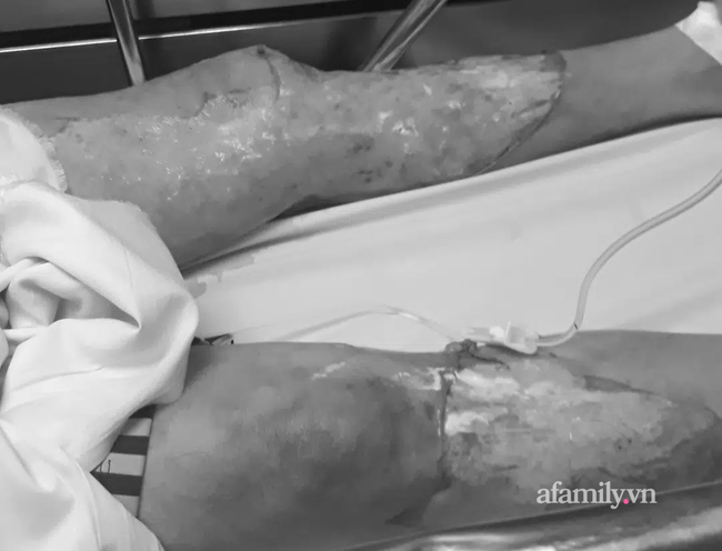 Con gái tố cáo phòng khám đông y xông hơi làm cha bị lột da khắp người, tử vong vì bỏng nặng-4