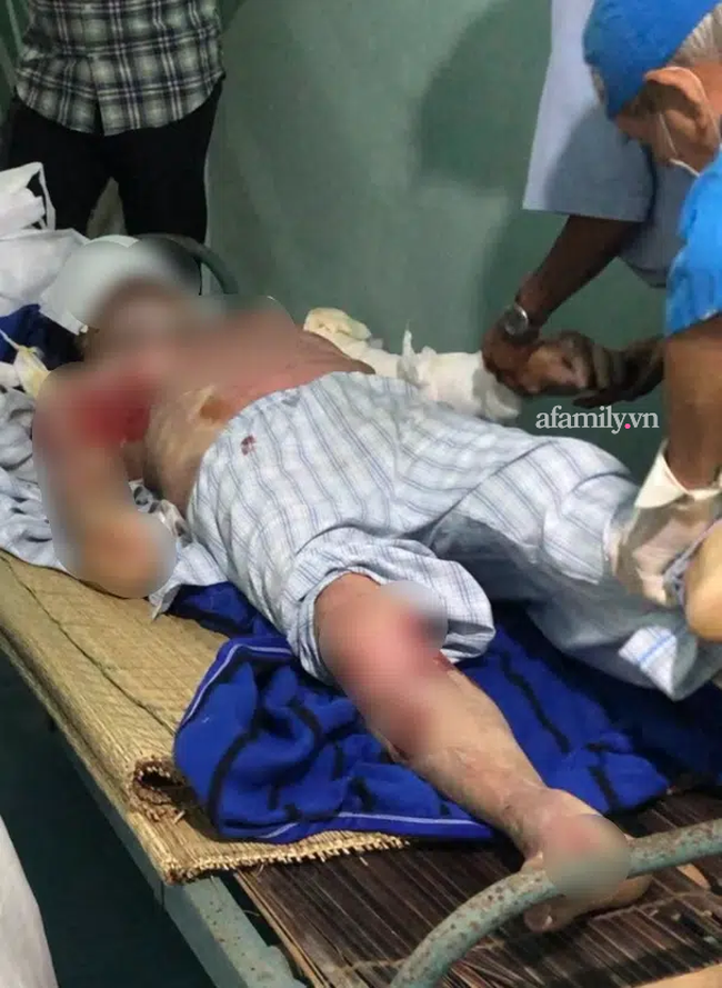 Con gái tố cáo phòng khám đông y xông hơi làm cha bị lột da khắp người, tử vong vì bỏng nặng-5