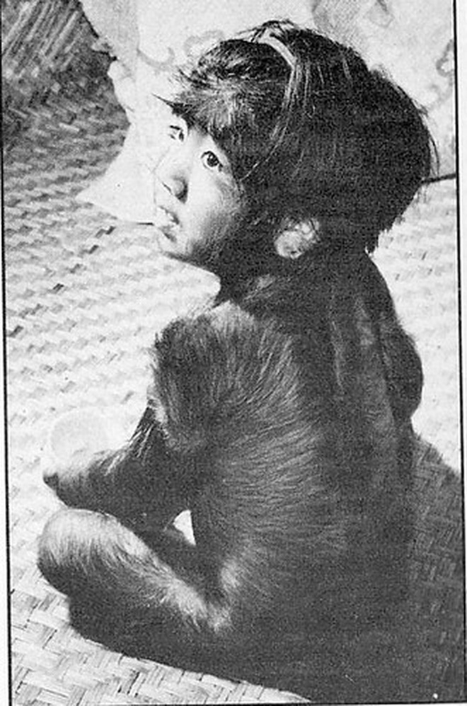 Cậu bé người vượn” sinh ra toàn thân phủ đầy lông bị gia đình ghét bỏ vì xấu xí gây bất ngờ với cuộc sống hiện tại bên bạn gái xinh đẹp-1