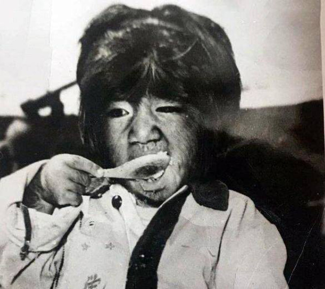 Cậu bé người vượn” sinh ra toàn thân phủ đầy lông bị gia đình ghét bỏ vì xấu xí gây bất ngờ với cuộc sống hiện tại bên bạn gái xinh đẹp-5