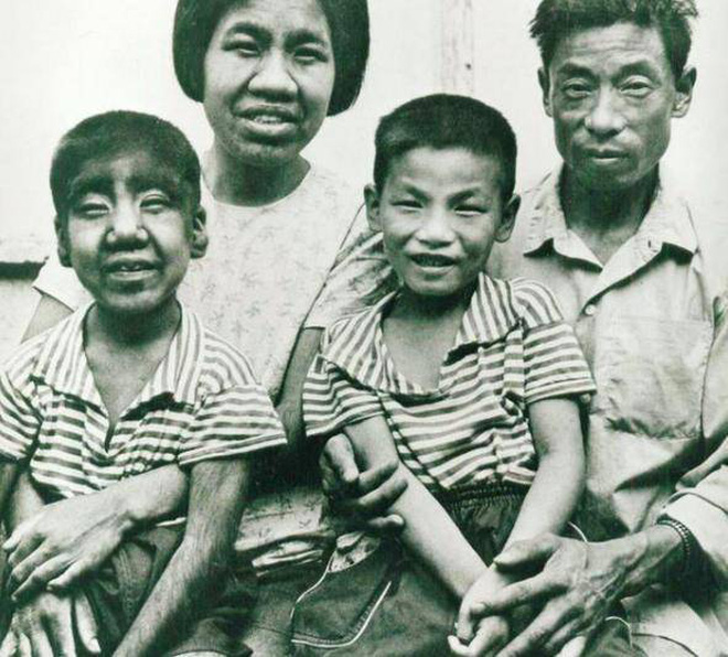 Cậu bé người vượn” sinh ra toàn thân phủ đầy lông bị gia đình ghét bỏ vì xấu xí gây bất ngờ với cuộc sống hiện tại bên bạn gái xinh đẹp-6