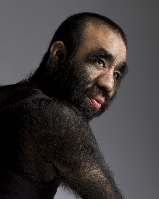 Cậu bé người vượn” sinh ra toàn thân phủ đầy lông bị gia đình ghét bỏ vì xấu xí gây bất ngờ với cuộc sống hiện tại bên bạn gái xinh đẹp-7