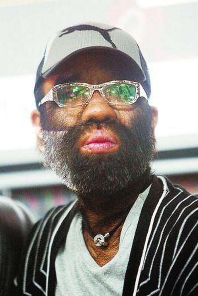 Cậu bé người vượn” sinh ra toàn thân phủ đầy lông bị gia đình ghét bỏ vì xấu xí gây bất ngờ với cuộc sống hiện tại bên bạn gái xinh đẹp-10