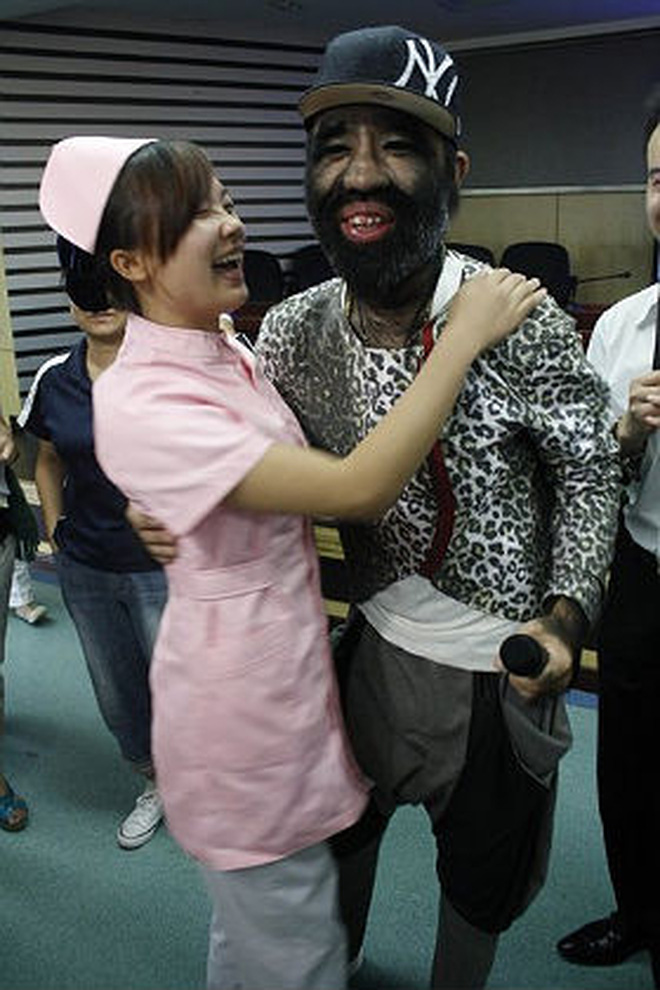 Cậu bé người vượn” sinh ra toàn thân phủ đầy lông bị gia đình ghét bỏ vì xấu xí gây bất ngờ với cuộc sống hiện tại bên bạn gái xinh đẹp-11