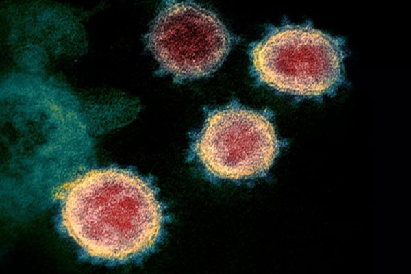 Biến thể virus SARS-CoV-2 tại Anh đã lan ra toàn thế giới-1