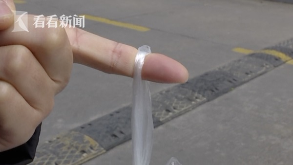 Người phụ nữ đột ngột đứt gân ngón tay khi đang đi vứt rác, nguyên nhân được tiết lộ khiến ai cũng phải tự ngẫm lại bản thân mình-2