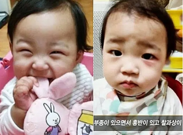 Vụ bé gái 16 tháng tuổi bị bố mẹ nuôi bạo hành đến chết: Con đang trong phòng cấp cứu nguy kịch, mẹ vẫn điềm nhiên mua bánh cá online-1