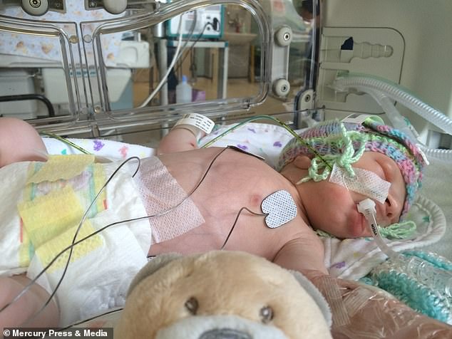 Bất chấp dự đoán chỉ có 5% khả năng sống sót, cậu bé sinh ra với nội tạng nằm ngoài cơ thể đã khiến nhiều người ngỡ ngàng sau 4 năm-3