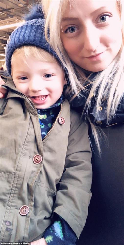 Bất chấp dự đoán chỉ có 5% khả năng sống sót, cậu bé sinh ra với nội tạng nằm ngoài cơ thể đã khiến nhiều người ngỡ ngàng sau 4 năm-8