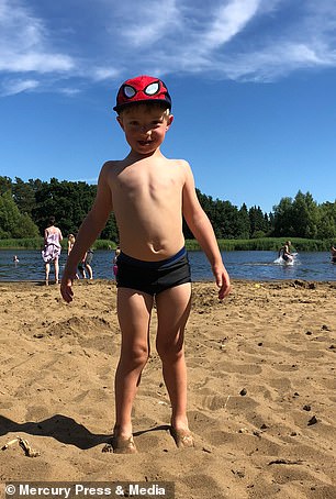 Bất chấp dự đoán chỉ có 5% khả năng sống sót, cậu bé sinh ra với nội tạng nằm ngoài cơ thể đã khiến nhiều người ngỡ ngàng sau 4 năm-9