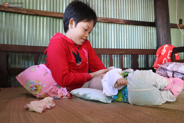 Xót cảnh bé gái 12 tuổi phải nghỉ học, cắt bỏ đôi chân sau trận sốt bại liệt: Tóc con dần rụng hết rồi-1