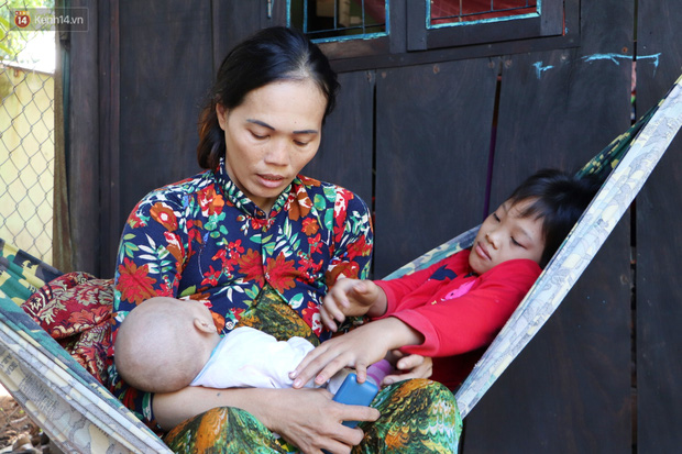 Xót cảnh bé gái 12 tuổi phải nghỉ học, cắt bỏ đôi chân sau trận sốt bại liệt: Tóc con dần rụng hết rồi-3