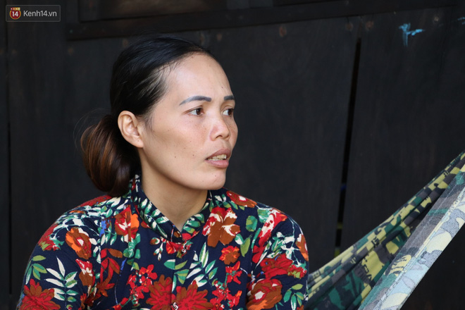 Xót cảnh bé gái 12 tuổi phải nghỉ học, cắt bỏ đôi chân sau trận sốt bại liệt: Tóc con dần rụng hết rồi-4