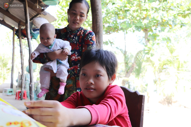 Xót cảnh bé gái 12 tuổi phải nghỉ học, cắt bỏ đôi chân sau trận sốt bại liệt: Tóc con dần rụng hết rồi-13