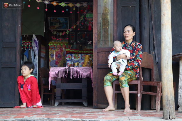 Xót cảnh bé gái 12 tuổi phải nghỉ học, cắt bỏ đôi chân sau trận sốt bại liệt: Tóc con dần rụng hết rồi-19