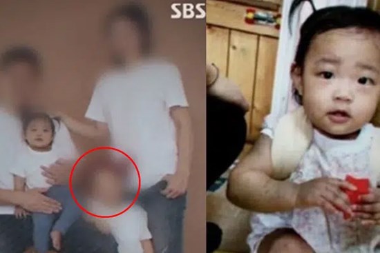 Vụ bé gái 16 tháng tuổi bị bạo hành đến chết: Hé lộ mục đích nhận nuôi đứa trẻ của cặp vợ chồng, có liên quan đến con gái ruột