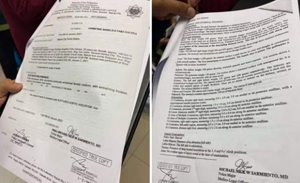 Lộ đoạn clip Á hậu Philippines hôn đắm đuối trai lạ trong khách sạn và thực hư tờ kết quả pháp y khẳng định không có dấu hiệu cưỡng hiếp-3