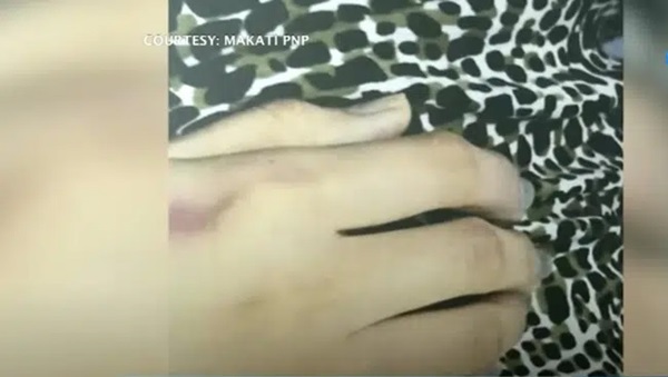 Công bố hình ảnh bầm tím khắp người của Á hậu Philippines, 3 nghi phạm được thả tự do bật khóc nức nở-1