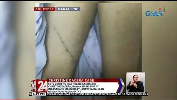 Công bố hình ảnh bầm tím khắp người của Á hậu Philippines, 3 nghi phạm được thả tự do bật khóc nức nở-2