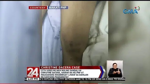 Công bố hình ảnh bầm tím khắp người của Á hậu Philippines, 3 nghi phạm được thả tự do bật khóc nức nở-3