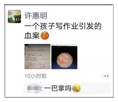 Cậu bé bị bố tát thủng màng nhĩ: Sao bố nói mãi mà con không làm được?”-1