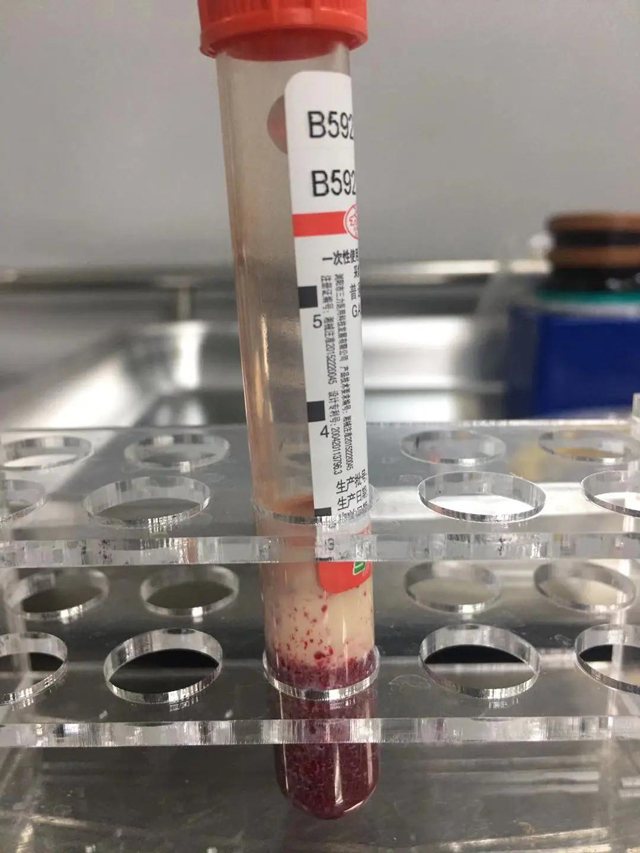 Nữ giáo viên hôn mê, tiểu không tự chủ, huyết tương giống như sữa dâu chỉ vì ngày nào cũng uống một thứ đồ uống-3