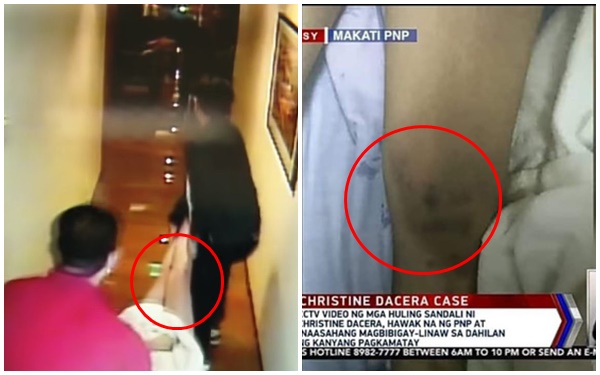 Truyền thông công bố hình ảnh Á hậu Philippines được đưa đi cấp cứu sau khi bất tỉnh, chân nạn nhân không có vết bầm như tư liệu từ cảnh sát-4