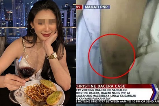 Truyền thông công bố hình ảnh Á hậu Philippines được đưa đi cấp cứu sau khi bất tỉnh, chân nạn nhân không có vết bầm như tư liệu từ cảnh sát