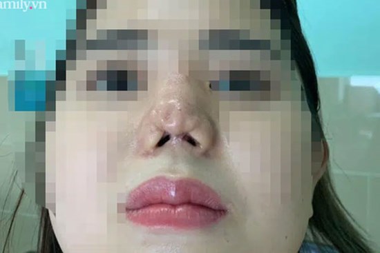TP.HCM: Cô gái 22 tuổi suy sụp tinh thần, uống 30 viên thuốc tự tử vì bị bác sĩ thẩm mỹ 