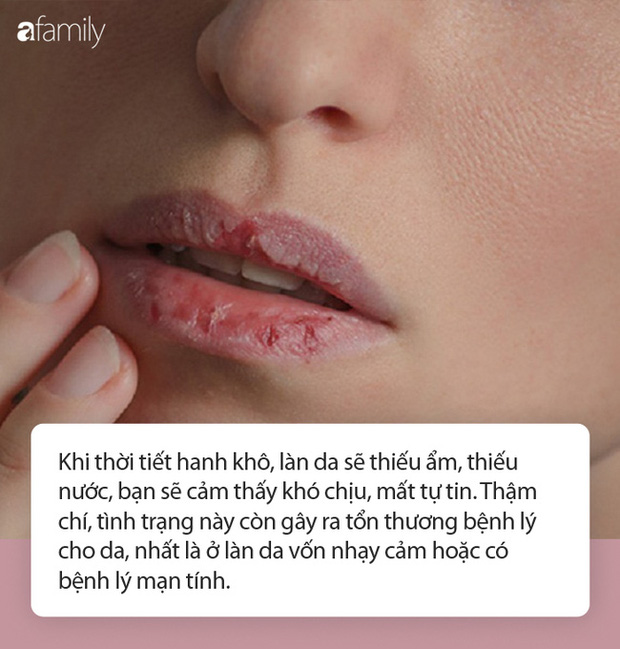 Mùa đông có ai không bị khô da: Chuyên gia da liễu tiết lộ 5 nguyên nhân, 5 dấu hiệu, 6 giải pháp chặn đứng thủ phạm làm da khô ráp, xù xì-2