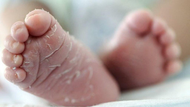 Mùa đông có ai không bị khô da: Chuyên gia da liễu tiết lộ 5 nguyên nhân, 5 dấu hiệu, 6 giải pháp chặn đứng thủ phạm làm da khô ráp, xù xì-3