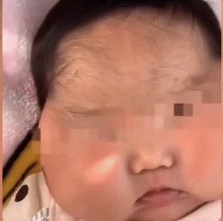 Con 5 tháng mặt mọc lông, tăng cân chóng mặt, bố mẹ sững sờ khi phát hiện bí mật nằm trong lọ kem dưỡng da hàng ngày-2