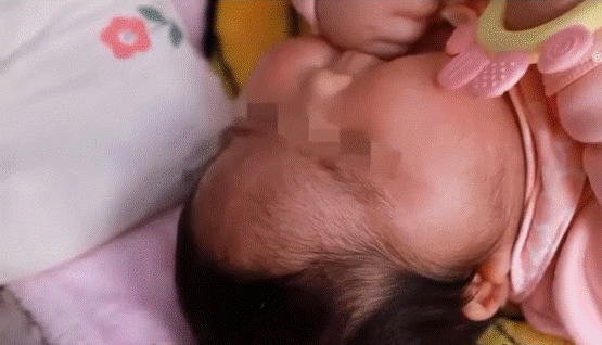 Con 5 tháng mặt mọc lông, tăng cân chóng mặt, bố mẹ sững sờ khi phát hiện bí mật nằm trong lọ kem dưỡng da hàng ngày-3