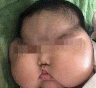 Con 5 tháng mặt mọc lông, tăng cân chóng mặt, bố mẹ sững sờ khi phát hiện bí mật nằm trong lọ kem dưỡng da hàng ngày-4