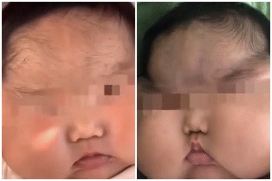 Con 5 tháng mặt mọc lông, tăng cân chóng mặt, bố mẹ sững sờ khi phát hiện bí mật nằm trong lọ kem dưỡng da hàng ngày