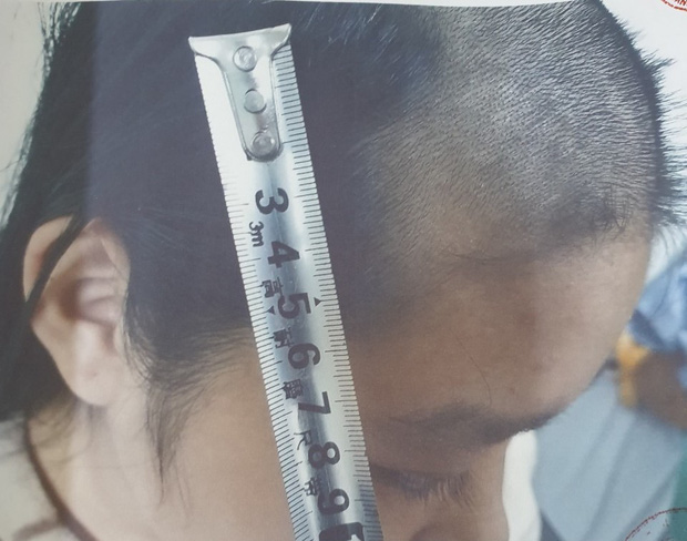 Bắc Ninh: Cha làm sẵn roi đánh đập con đẻ 5 tuổi đến ngất lịm, hành hạ bé suốt thời gian dài sau mỗi lần sử dụng ma tuý-1