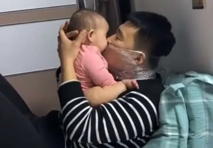 Đang âu yếm con gái mà trên mặt ông bố lại quấn mấy lớp nilon, biết nguyên do ai cũng khen hết lời-1