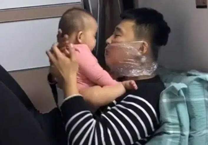 Đang âu yếm con gái mà trên mặt ông bố lại quấn mấy lớp nilon, biết nguyên do ai cũng khen hết lời-2