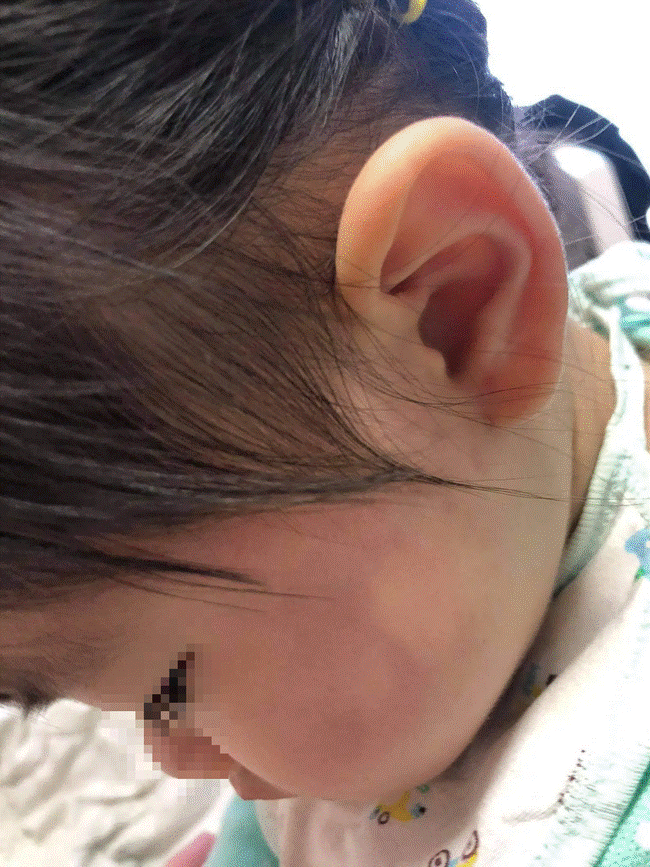Trẻ không ngủ, nữ giúp việc bạo hành bé tới thâm tím má, nói dối với bố mẹ bé tự ngã dù được trả lương cao, đối đãi hậu hĩnh như người nhà-4