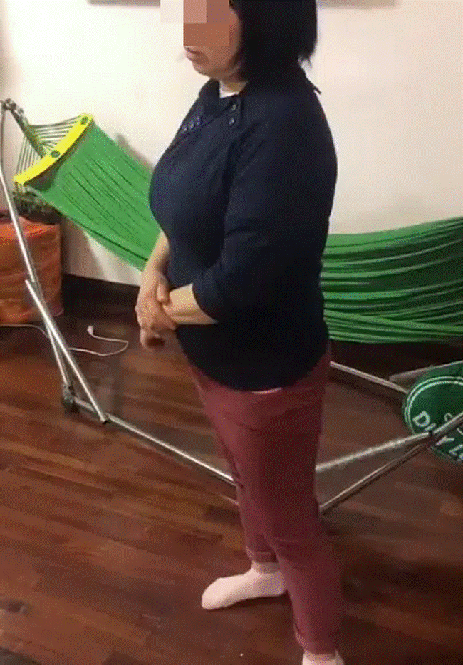 Trẻ không ngủ, nữ giúp việc bạo hành bé tới thâm tím má, nói dối với bố mẹ bé tự ngã dù được trả lương cao, đối đãi hậu hĩnh như người nhà-6