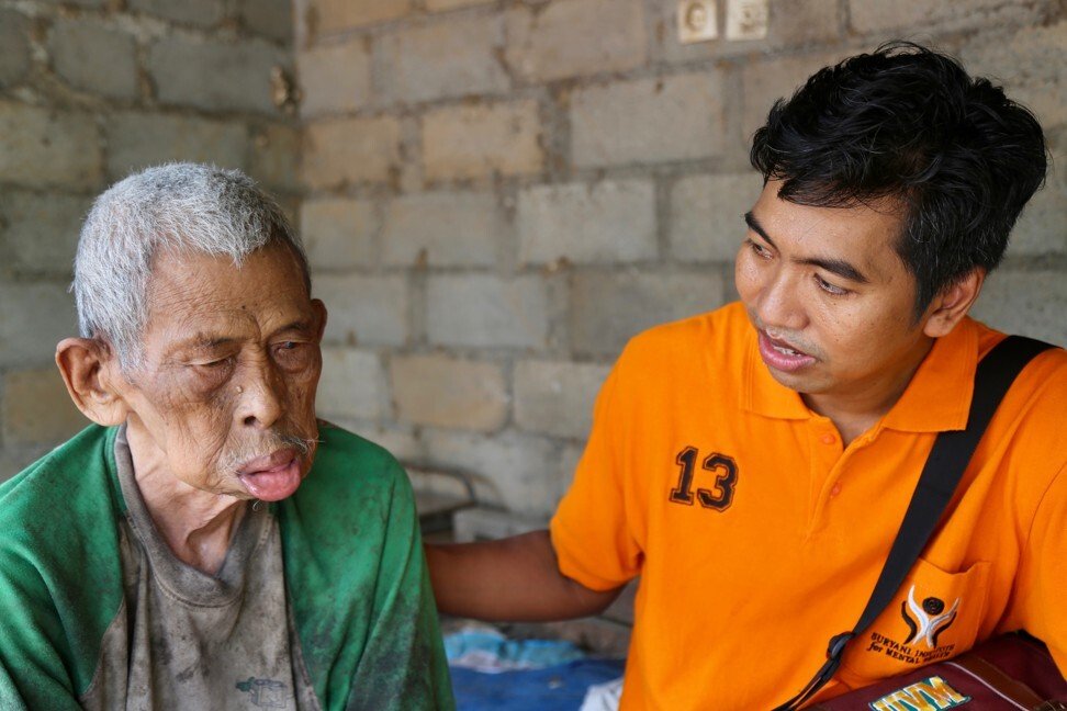 Có một địa ngục ở giữa thiên đường du lịch Bali: Nơi bệnh nhân tâm thần đang bị xiềng xích bởi tục lệ truyền thống man rợ-1