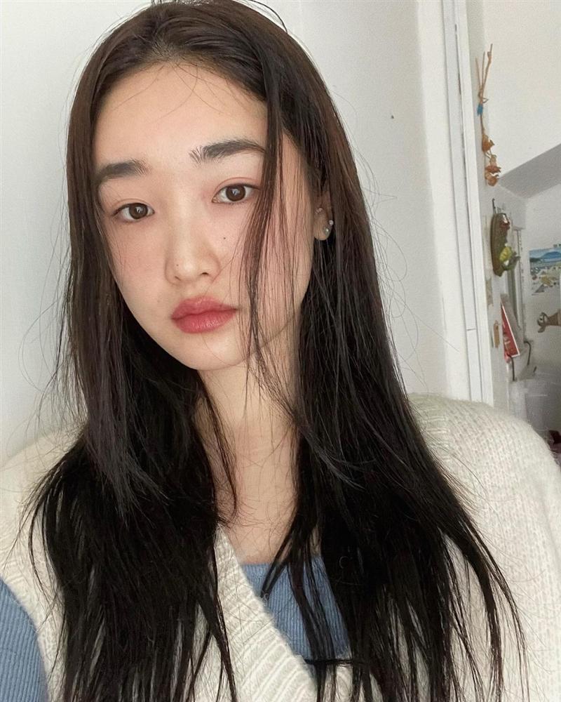 Tóc bết bền bệt” và đầy gàu trong mùa đông? Bạn có thể cải thiện ngay bằng việc gội đầu cho đúng cách-2