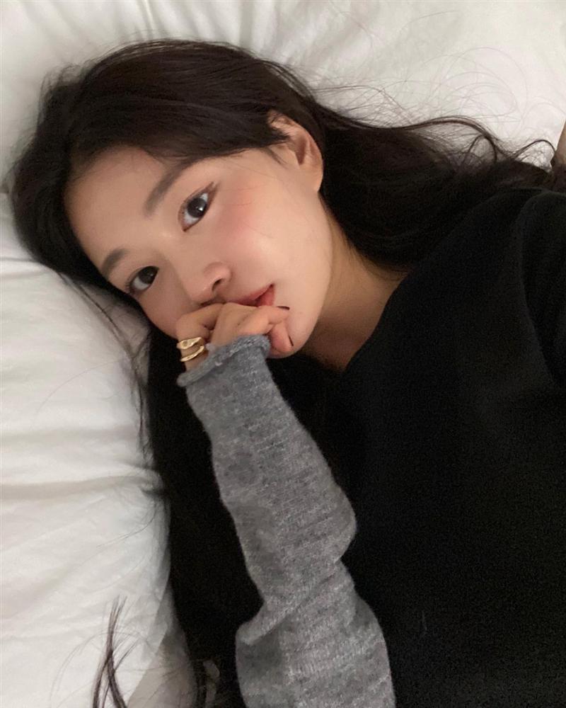 Tóc bết bền bệt” và đầy gàu trong mùa đông? Bạn có thể cải thiện ngay bằng việc gội đầu cho đúng cách-4