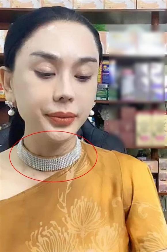 Lâm Khánh Chi lộ vùng cổ nhăn nheo, chi chít nốt sần khiến ai nấy rùng mình-1