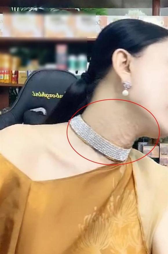 Lâm Khánh Chi lộ vùng cổ nhăn nheo, chi chít nốt sần khiến ai nấy rùng mình-3