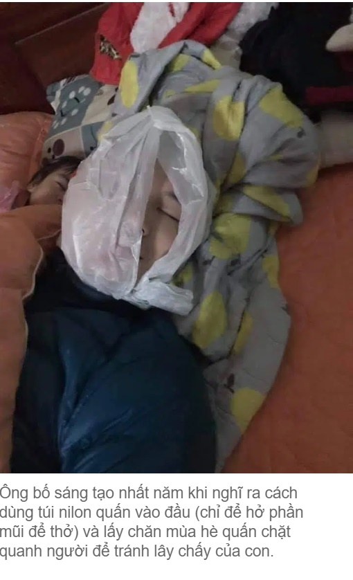 Biết con bị chấy, pha xử lý độc nhất vô nhị” của ông bố khiến cộng đồng mạng cười chảy nước mắt-1