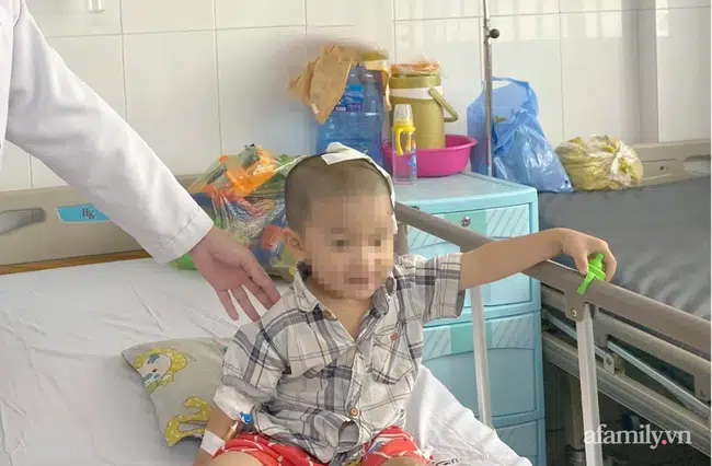 Tai nạn kinh hoàng: Anh lấy xe đạp chở em út quanh xóm rồi bị té, bé trai 2 tuổi lõm sọ não-3
