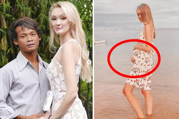 Chàng trai mặt quỷ nên duyên, thề non hẹn biển với người vợ xinh đẹp giờ có cuộc sống ra sao sau 2 năm?-6