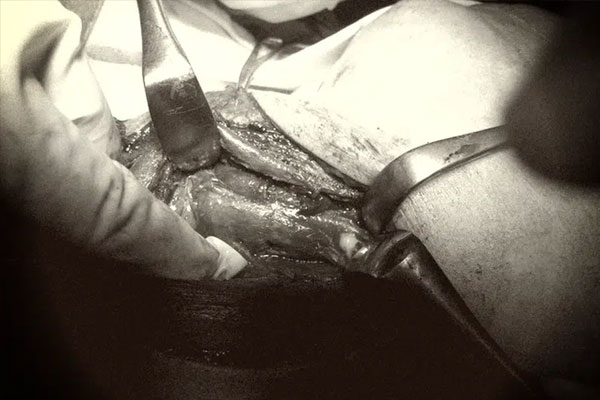 Bị cha mẹ mắng ham chơi không lo học, bé gái 15 tuổi uống 28 viên thuốc trầm cảm suýt chết-2